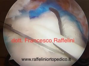 Francesco Raffelini